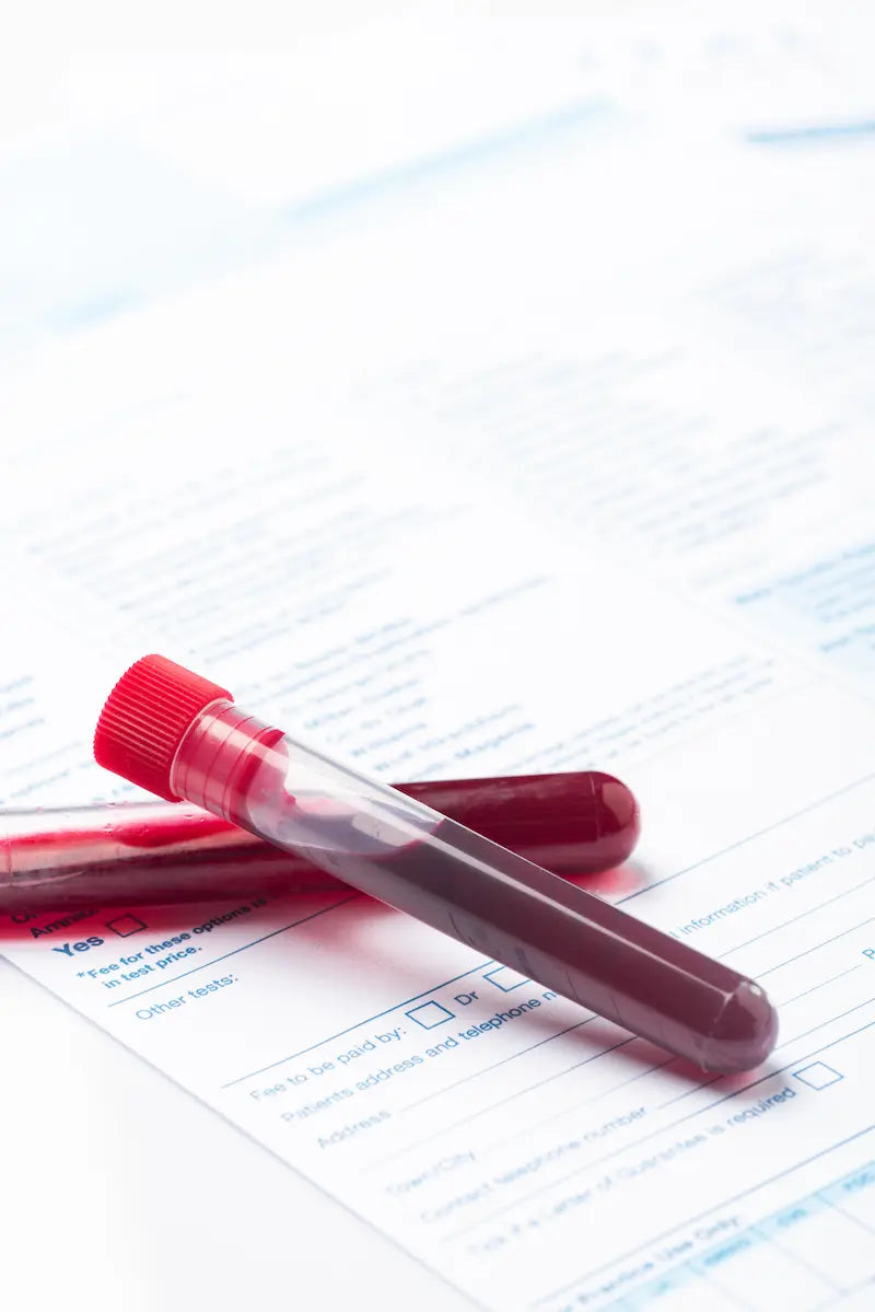 Estudio Preventivo Avanzado  de sangre y orina