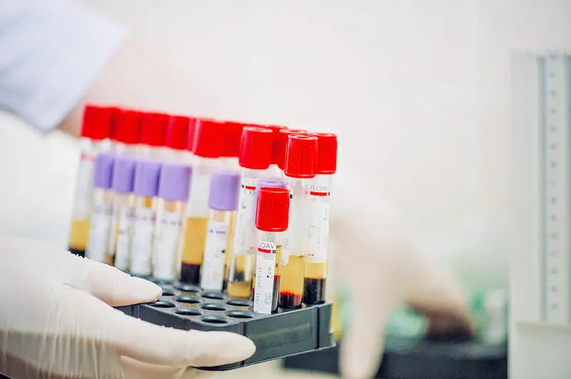 Estudio Preventivo de sangre y orina